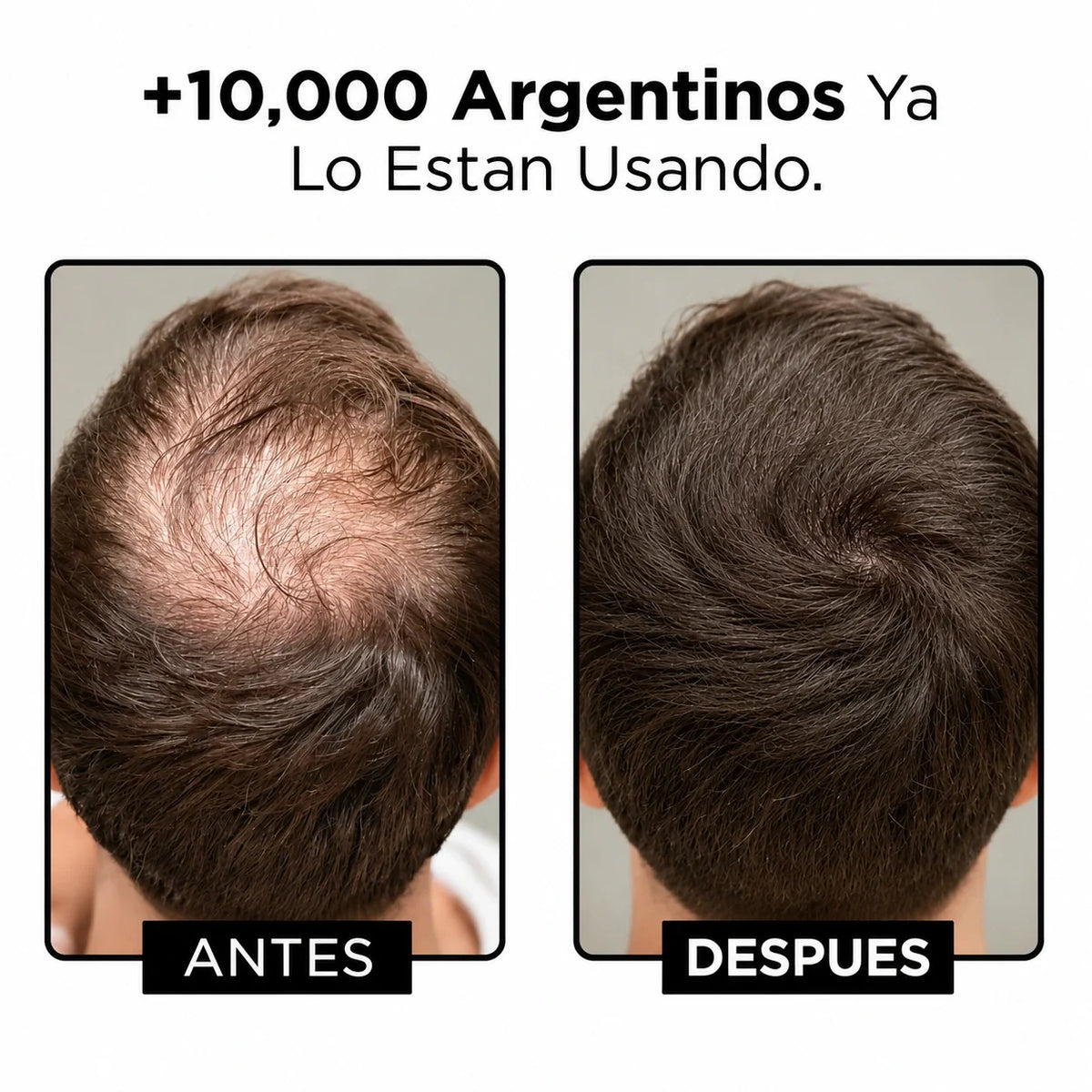 KIT ANTICAIDA | Recuperá tu Pelo: Frená la Caída y Estimulá el Crecimiento