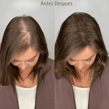 KIT ANTICAIDA | Recuperá tu Pelo: Frená la Caída y Estimulá el Crecimiento