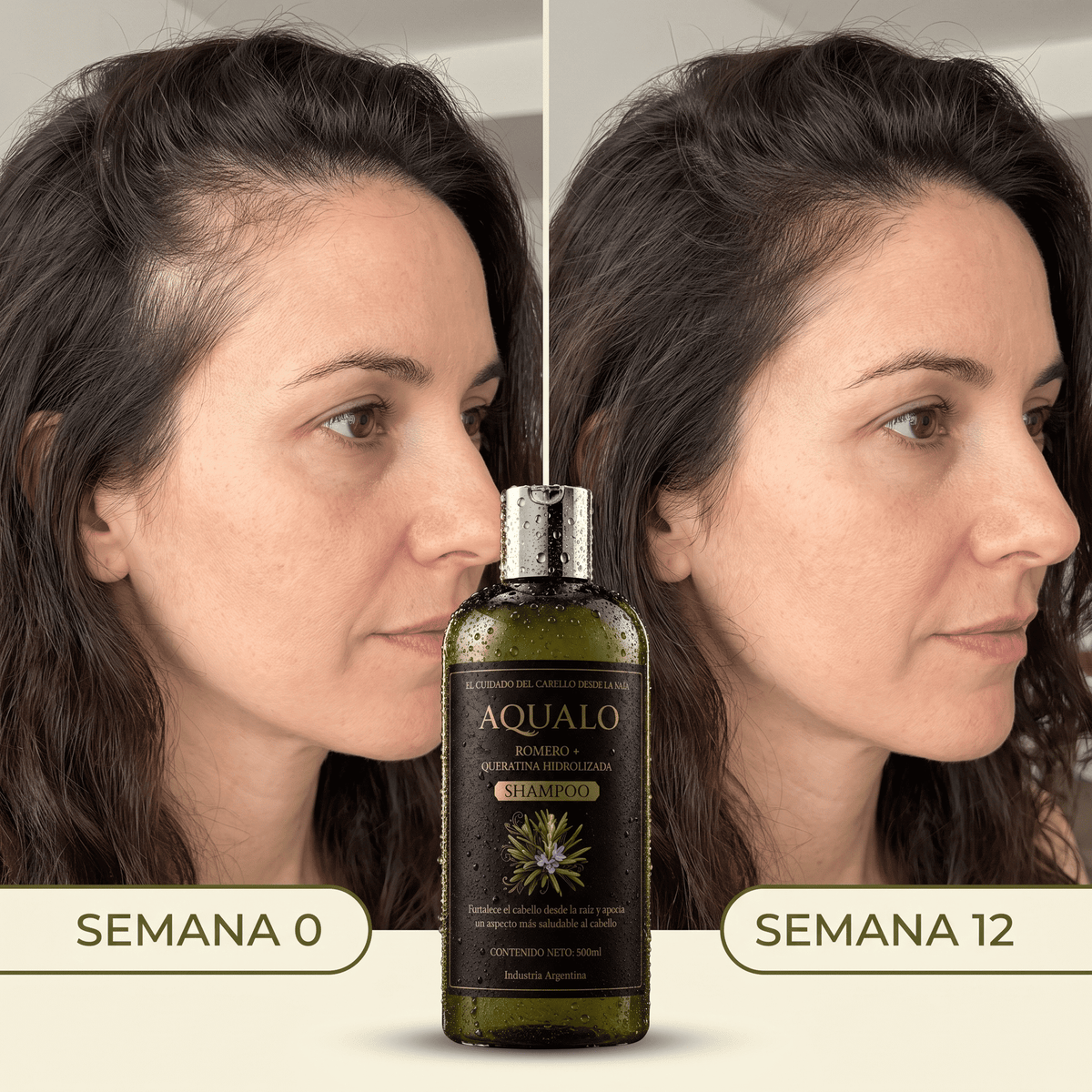 AQUALO™ Shampoo Anticaída y Crecimiento